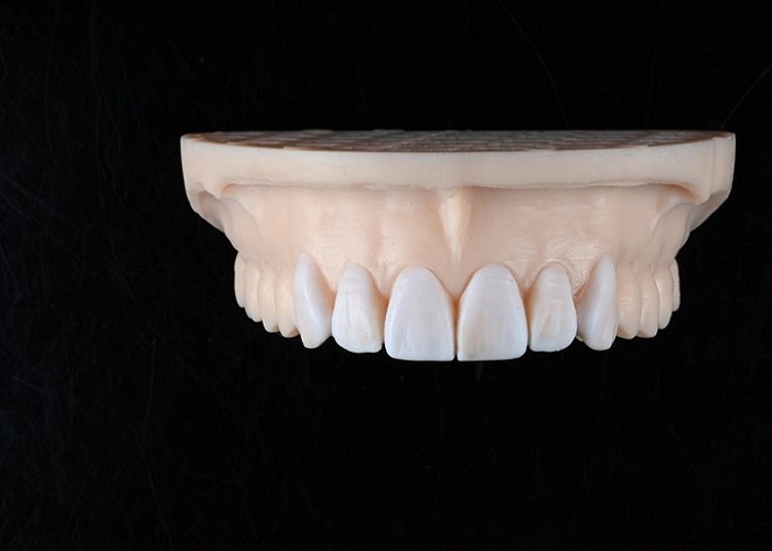 Production Process of Digital Wax-Up