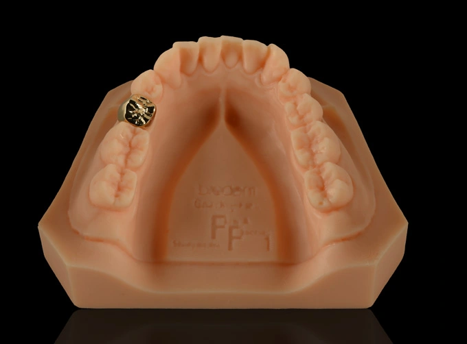 gold crown implant