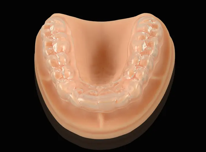 custom dental night guard