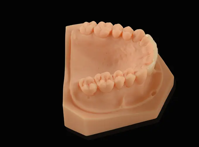 zirconia veneers cost