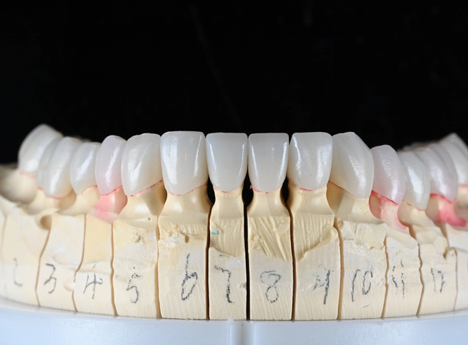 layered zirconia crown cost
