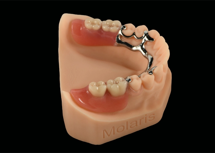 Enhance Your Smile with Golden Smile Dental Lab's Revolutionary Orthodontic Products