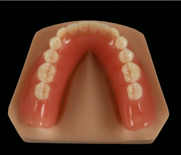 What is a Full Acrylic Denture?