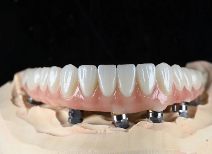 What is a Full Arch Zirconia?
